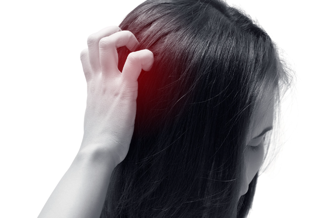 Alopecia seborreica, ¿Es reversible?